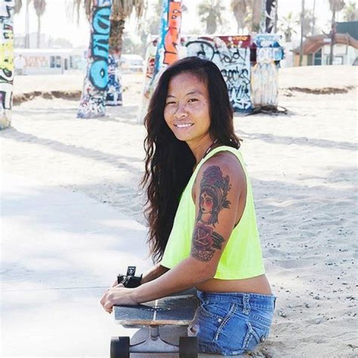 Model Born Without Legs