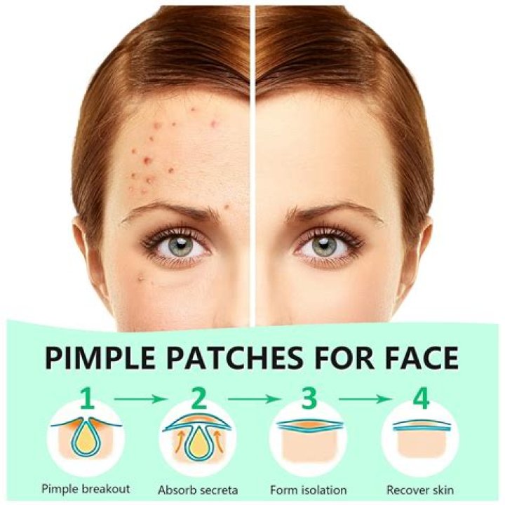 pimple patch