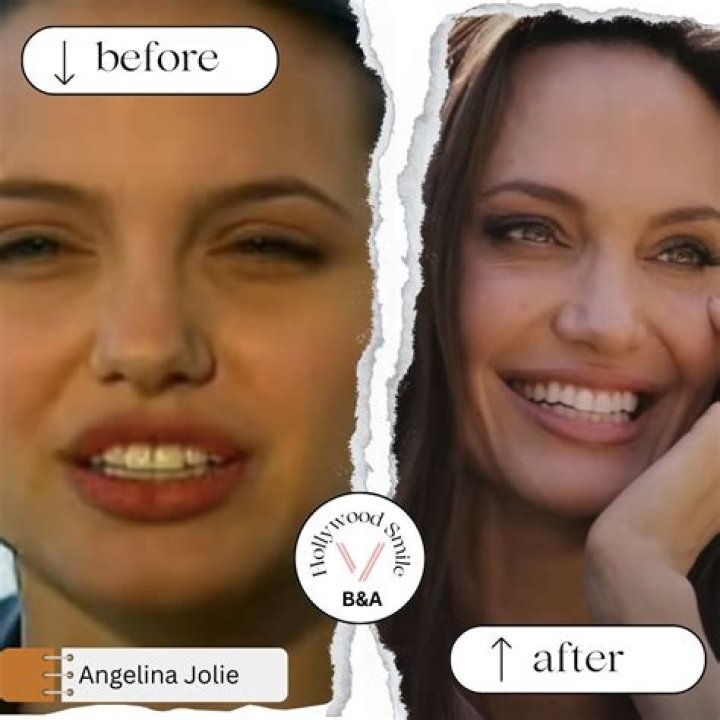 See Transformations & Makeovers – Hollywood Life